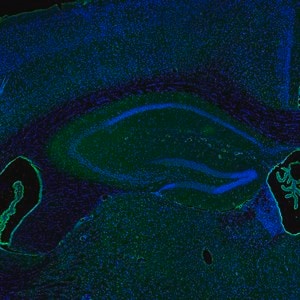 Merck Anti-IER5 antibody produced in rabbit