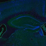 Merck Anti-IER5 antibody produced in rabbit