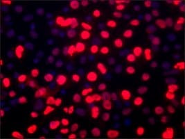 Merck Anti-BMI1 (C-terminal) antibody produced in rabbit