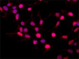 Merck Anti-BMI1 antibody produced in rabbit
