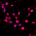 Merck Anti-BMI1 antibody produced in rabbit