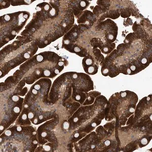 Merck Anti-B3GNTL1 antibody produced in rabbit