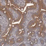 Merck Anti-CTBS antibody produced in rabbit