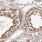 Merck Anti-RNF19A antibody produced in rabbit