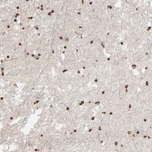 Merck Anti-AFF4 antibody produced in rabbit