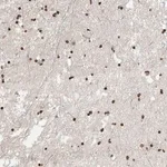 Merck Anti-AFF4 antibody produced in rabbit