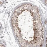 Merck Anti-SSX2IP antibody produced in rabbit