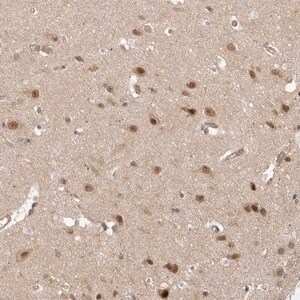 Merck Anti-DCAF8 antibody produced in rabbit