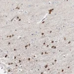 Merck Anti-HIPK4 antibody produced in rabbit