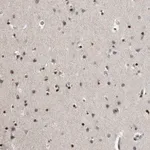 Merck Anti-EVI5 antibody produced in rabbit