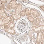Merck Anti-TTC3 antibody produced in rabbit
