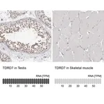 Merck Anti-TDRD7 antibody produced in rabbit