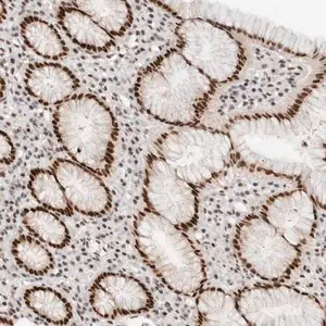 Merck Anti-GTF2I antibody produced in rabbit