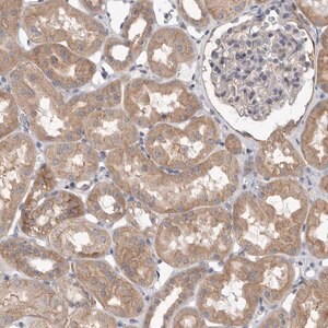 Merck Anti-VAC14 antibody produced in rabbit