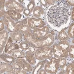 Merck Anti-VAC14 antibody produced in rabbit