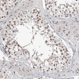 Merck Anti-TRIM66 antibody produced in rabbit