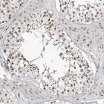 Merck Anti-TRIM66 antibody produced in rabbit