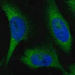 Merck Anti-KLHL28 antibody produced in rabbit