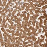 Merck Anti-MAGEB17 antibody produced in rabbit