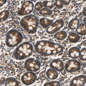 Merck Anti-C1orf198 antibody produced in rabbit