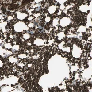 Merck Anti-ANK1 antibody produced in rabbit
