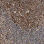 Merck Anti-RIOK2 antibody produced in rabbit