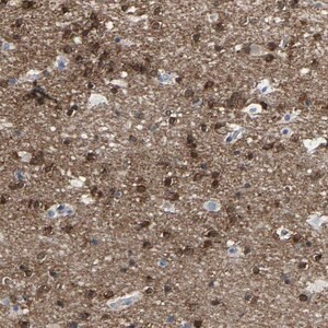 Merck Anti-ABTB2 antibody produced in rabbit