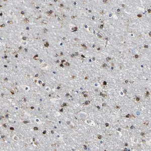 Merck Anti-DUSP8 antibody produced in rabbit