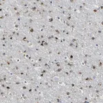 Merck Anti-DUSP8 antibody produced in rabbit