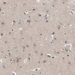 Merck Anti-PCNX2 antibody produced in rabbit