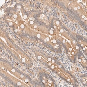 Merck Anti-TNK1 antibody produced in rabbit