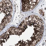 Merck Anti-TBC1D15 antibody produced in rabbit