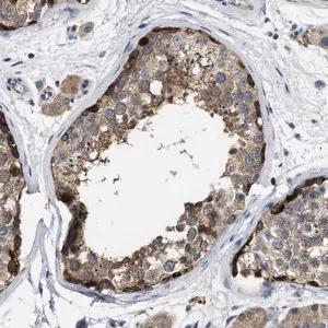Merck Anti-TMEM131 antibody produced in rabbit