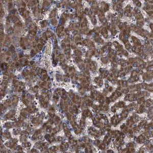Merck Anti-GPR179 antibody produced in rabbit