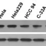 Merck Anti-URGCP antibody produced in rabbit