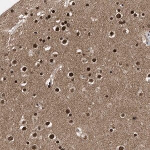 Merck Anti-ZNF346 antibody produced in rabbit