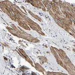 Merck Anti-KCTD17 antibody produced in rabbit