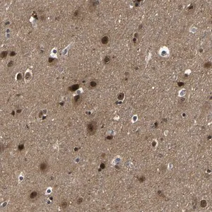 Merck Anti-PPM1E antibody produced in rabbit