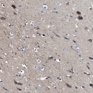 Merck Anti-SLC38A6 antibody produced in rabbit