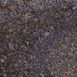 Merck Anti-ACCS antibody produced in rabbit