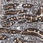 Merck Anti-WDR60 antibody produced in rabbit