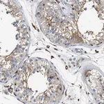 Merck Anti-NSUN7 antibody produced in rabbit