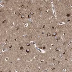 Merck Anti-GUCY1B3 antibody produced in rabbit