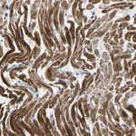 Merck Anti-AGK antibody produced in rabbit