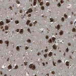 Merck Anti-ARHGEF5 antibody produced in rabbit