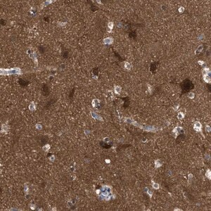 Merck Anti-RAP1GDS1 antibody produced in rabbit