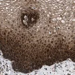 Merck Anti-PRDM14 antibody produced in rabbit