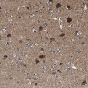 Merck Anti-CIT antibody produced in rabbit