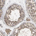 Merck Anti-AIMP2 antibody produced in rabbit