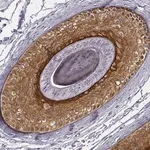 Merck Anti-KRT75 antibody produced in rabbit